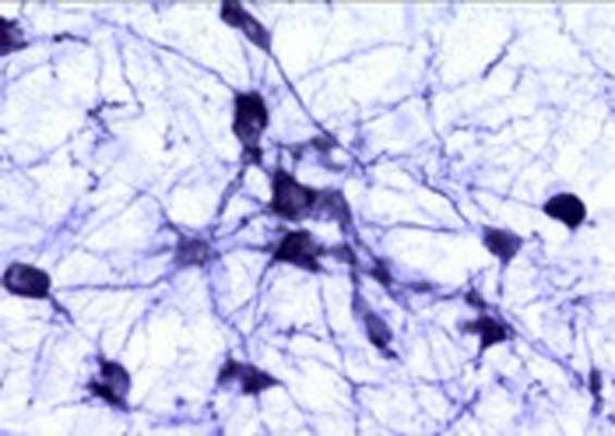 Immunohistochemical staining of catecholaminergic neurons in the rat brain stem.