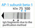 Western blot analysis on human brain lysate under reducing conditions using Rabbit antibody to AP-1 complex subunit beta-1 (11-29): whole serum (R-167-100) at a dilution of 1: 100. This antibody labels a major protein of approximately 100 kDa of molecular weight and several minor proteins around 70 kDa in both rat and human tissue. The presence of the two lower bands (IgG fragments) is due to the magnetic bead purification method employed.