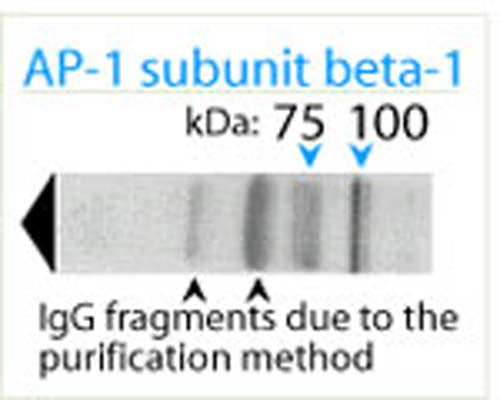 Western blot analysis on human brain lysate under reducing conditions using Rabbit antibody to AP-1 complex subunit beta-1 (11-29): whole serum (R-167-100) at a dilution of 1: 100. This antibody labels a major protein of approximately 100 kDa of molecular weight and several minor proteins around 70 kDa in both rat and human tissue. The presence of the two lower bands (IgG fragments) is due to the magnetic bead purification method employed.