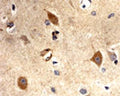 Immunohistochemical detection (DAB staining) of superoxide dismutase (SOD1) in paraffin embedded human brain tissue using Rabbit antibody to superoxide dismutase (SOD1; 121-139): whole serum (R-168-100) at a dilution of 1: 100 incubated overnight. Secondary antibody was biotinylated goat anti-rabbit used at a dilution of 1: 3000 together with Vector ABC. This antibody labels neurons and some glial cells in human brain tissue. Other tissues have not yet been tested.