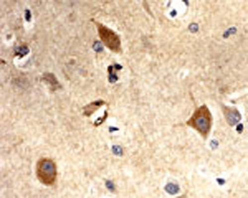 Immunohistochemical detection (DAB staining) of superoxide dismutase (SOD1) in paraffin embedded human brain tissue using Rabbit antibody to superoxide dismutase (SOD1; 121-139): whole serum (R-168-100) at a dilution of 1: 100 incubated overnight. Secondary antibody was biotinylated goat anti-rabbit used at a dilution of 1: 3000 together with Vector ABC. This antibody labels neurons and some glial cells in human brain tissue. Other tissues have not yet been tested.
