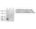 Detection of SOD1 protein (16 kDa) in SH-SY5Y cell lysates with R-168-100. This antibody does not detect SOD1 in mouse and rat tissue samples. Proteins were separated by reduced SDS-PAGE, transferred to nitrocellulose membrane. Blots were incubated with R-168-100 at 1:1000 dilution using an anti-rabbit-HRP conjugate (1:10000) as secondary antibody.