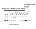 Western Immunoblotting of mouse and human Presenilin 2 protein in mouse cell line extracts, various mouse tissues and a human cell line. Membrane proteins were prepared and loaded as 20 µg protein per lane. Crude anti-PS2 loop antibody used at 1:1000.