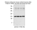 Western blotting for DJ-1 in extracts of primary cultured neurons. Samples resolved on 10% Tris-tricine gels and transferred to nitrocellulose membrane for blotting.