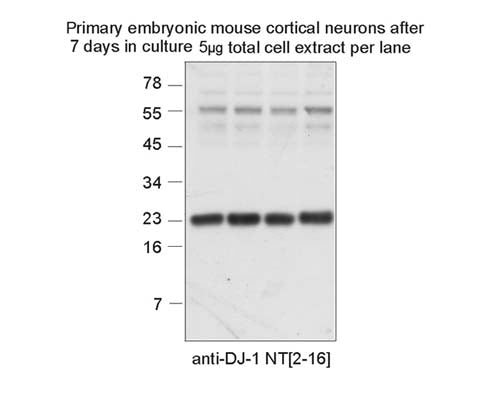 Western blotting for DJ-1 in extracts of primary cultured neurons. Samples resolved on 10% Tris-tricine gels and transferred to nitrocellulose membrane for blotting.