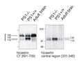 Western Immunoblotting with nicastrin central region antibody of mouse Nicastrin protein in PS1-deficient cell line and adult mouse brain (right panel) in comparison with C-terminal Nicastrin antibody (Catalog number R-1684-500). Membrane proteins were prepared and loaded as 20 µg protein per lane.