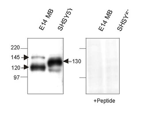 Western Immunoblotting with nicastrin N-terminal domain antibody (Catalog Number R-1686-500) of mouse and human Nicastrin protein in embryonic mouse brain and a human cell line (SHSY5Y). Membrane proteins were prepared and loaded as 20 µg protein per lane. Immunizing peptide absorption removed antibody reactivity.