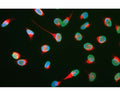 HeLa cells stained with Rabbit anti-Vimentin (R-1699-100) (red) and counterstained with Monoclonal antibody to Lamin A/C (green, M-1689-100). DNA is blue. R-1699-100 antibody reveals strong cytoplasmic intermediate filament staining, while M-1689-100 antibody reveals strong nuclear lamina staining.