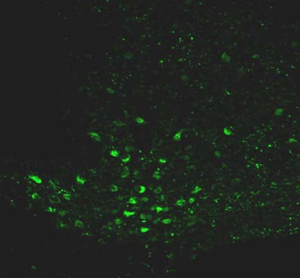 IHC staining of Neuropeptide Y cells and terminals in the arcuate nucleus of mouse brain sections with Rabbit anti-NPY antibody (R-1716-50). Dilution: 1:2000.