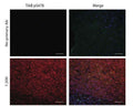 Immunohistochemical analysis of TrkB (pS478) expression in mouse cerebral cortex, including corpus callosum, using rabbit antibody R-1718-50. Mice were perfused (4% PFA), post-fixed followed by cryopreservation with 30% sucrose and frozen on isopentane. Saggittal cryostat sections were blocked with 10% NDS, 1% BSA in 1x TBS with 0.3% Triton-X100 (15 min, room temperature). Sections were incubated with primary antibody R-1718-50 (1:200, red) at 2-8°C overnight, with subsequent application of donkey anti-rabbit-Alexa594 secondary antibody (1:400, 2 hour incubation at room temperature). Sections were co-labelled with goat anti-PDGFRa (green) as positive control. Scale bar = 100 µm. Images courtesy of Dr Jessica Fletcher, University of Melbourne, Australia.
