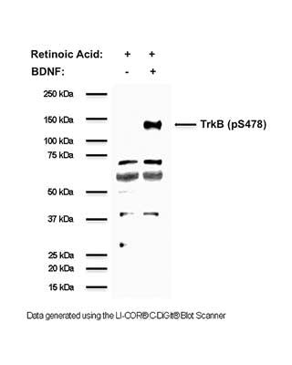 Anti-TrkB phospho Ser478/479 Antibody