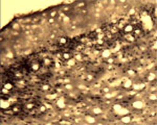 Immunohistochemical detection of Arg3.1 in free floating cryosectioned rat brain (Cortex) using Rabbit antibody to Arg3.1 (ARC): IgG (R-173-500) at a concentration of 2 µg/mL.