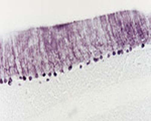 Anti-Neurotrophin-3 (NT-3) Antibody