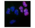 Analysis of Ki67 expression in cultured HeLa cells with rabbit anti-Ki67 antibody (red, 1:5,000), and mouse anti-fibrillarin (M-1372-250, green, 1:2,000) by Immunocytochemistry. Blue: DAPI nuclear stain. Ki67 protein accumulates in and around the nucleoli of interphase cells such as those on the right, and the nucleoli are revealed by the fibrillarin antibody. In contrast, cells in the quiescent G0 state such as those on the left are Ki67 negative, but fibrillarin-positive.