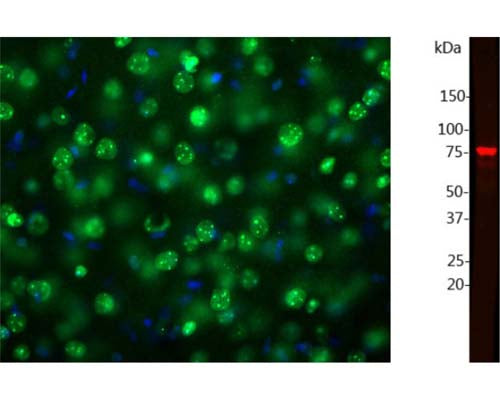 Left: Staining of mouse brain section with rabbit antibody to MeCP2 (green) by Immunohistochemistry. MeCP2 is mainly associated with methylated DNA in nucleus of neuronal cells. Blue: DAPI nuclear stain. IHC method: Following transcardial perfusion of mouse with 4% paraformaldehyde, brain was post fixed overnight and cut to 45 uM. Right: Western blot analysis of MeCP2 expression in nuclear extracts from mouse brain. This antibody recognizes a strong and clear band at 74 kDa corresponding to MeCP2. The molecular weight of MeCP2 is 52 KDa, however, on SDS-PAGE this protein migrates slower due to its unusual high positive charge density.