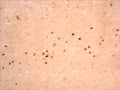 This antibody stains LRRK2 positive tangles in inferior temporal cortex of human brain affected by Alzheimer's disease, when used at a dilution of 1:500.