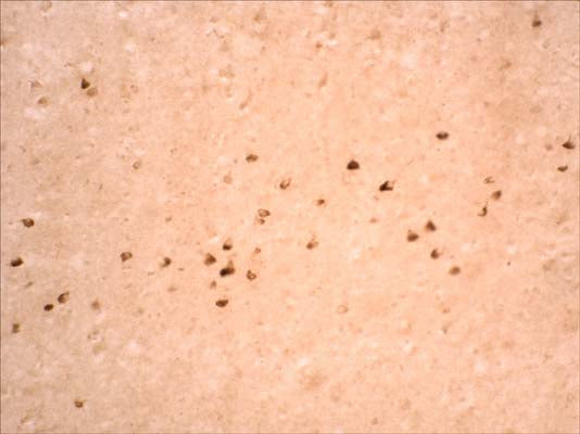 This antibody stains LRRK2 positive tangles in inferior temporal cortex of human brain affected by Alzheimer's disease, when used at a dilution of 1:500.