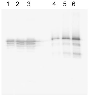 Western blot analysis on recombinant human Tau purified from E.Coli (lanes 1-3; 10, 20 and 40 µg respectively) and on porcine brain lysate (lanes 4-6; 20, 40, 80 ng respectively) under reducing conditions using Rabbit antibody to human Microtubule-associate protein Tau: whole serum (R-184-100) at a dilution of 1: 500. This antibody detected recombinant human Tau with the smaller fragments likely representing degradation products from the purified protein, which has been expressed in E. Coli. In the porcine cytosol, this antibody detected several bands that represents the different Tau isoforms and likely phosphorylated species. This polyclonal antibody is independent of phosphorylation.