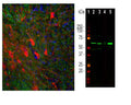 Left: Visualization of tyrosine hydroxylase expression in rat brain by Immunofluorescent analysis. Section was stained with rabbit anti-TH antibody, R-2120-100, (red, 1:10,000); costained with mouse antibody to pNF-H (green, 1:1,000); and Hoechst staining of nuclear DNA (blue). Following transcardial perfusion of rat with 4% paraformaldehyde, the brain was post fixed for 24 hours and cut into 45µM free floating sections for staining. Product R-2120-100 stains the striatal TH expressing interneurons. Right:  Western blot analysis of tissues and lysates using R-2120-100 (green, 1:5,000) with a band at approx. 60kDa in brain and PC12 extracts. Lane 1: protein standard (red); Lane 2: rat brain; Lane 3: mouse brain; Lane 4: SH-SY5Y cells; Lane 5: PC12 cells.