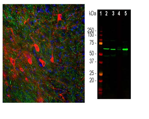 Left: Visualization of tyrosine hydroxylase expression in rat brain by Immunofluorescent analysis. Section was stained with rabbit anti-TH antibody, R-2120-100, (red, 1:10,000); costained with mouse antibody to pNF-H (green, 1:1,000); and Hoechst staining of nuclear DNA (blue). Following transcardial perfusion of rat with 4% paraformaldehyde, the brain was post fixed for 24 hours and cut into 45µM free floating sections for staining. Product R-2120-100 stains the striatal TH expressing interneurons. Right:  Western blot analysis of tissues and lysates using R-2120-100 (green, 1:5,000) with a band at approx. 60kDa in brain and PC12 extracts. Lane 1: protein standard (red); Lane 2: rat brain; Lane 3: mouse brain; Lane 4: SH-SY5Y cells; Lane 5: PC12 cells.