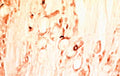 Immunohistochemical staining of Glial Derived Neurotrophic Factor (GDNF) in rat dorsal root ganglia using sheep polyclonal antibody to recombinant human GDNF, catalogue number S-021-50.