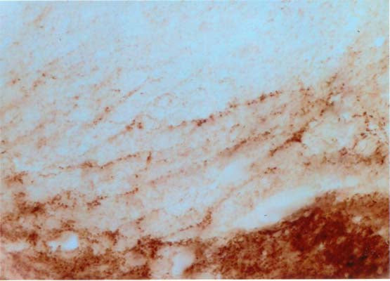 Immunohistochemical detection of beta synuclein in rat spinal cord using Sheep antibody to beta synuclein (108-125): whole serum, catalogue no. S-041-100, at a dilution of 1:4000.