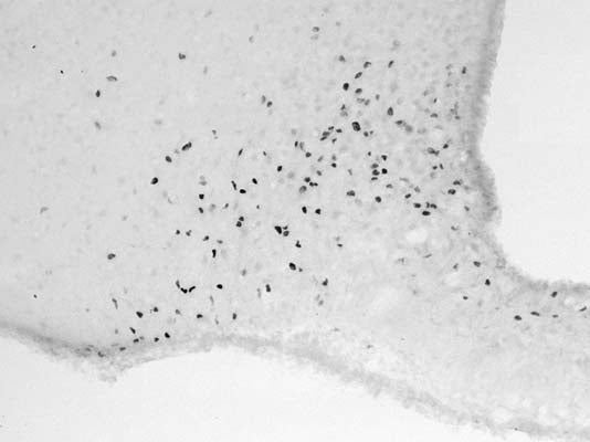 c-Fos was induced in the hypothalamic arcuate nucleus of an adult male Wistar rat with i.p. injection of N-methyl-D-aspartate. The brain was fixed by transcardiac perfusion of the rat with formaldehyde (4%). cFos immunoreactivity was detected on floated cryo-sections of the hypothalamic arcuate nucleus with the S-045-50 primary antibody (1:5000) using the biotinylated secondary antibody-ABC method and nickel-diaminobenzidine chromogen. Photo courtesy of Dr. Erik Hrabovszky, Hungarian Academy of Sciences, Budapest, Hungary.
