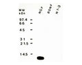 Nerve growth factor (NGF) immunoreactivity using sheep polyclonal to native mouse NGF, catalogue number S-051-50.