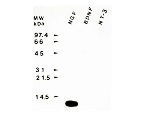 Nerve growth factor (NGF) immunoreactivity using sheep polyclonal to native mouse NGF, catalogue number S-051-50.