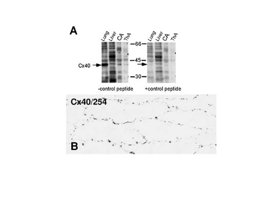A: Western blotting of tissue extracts from rat brain, heart, lung, liver, caudal artery (CA) and thoracic aorta (ThA) using S-063-100. Arrows show the position of the expected Cx band. The left panels represent incubation with Cx antibody whereas right panels represent pre-incubation of the antibody with immunogenic peptide (adapted from Rummery, NM et al 2002, Supplementary Figure VII.)B: Immunohistochemistry. En face view of Cx expression in endothelial cells of rat thoracic aorta with antibody S-063-100. Plaques can be seen outlining the perimeter of endothelial cells (adapted from Rummery, NM et al. 2002, Supplementary Figure IV.)