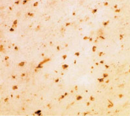 Anti-Alpha-synuclein Antibody