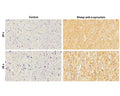 Analysis of _-synuclein expression in formalin-fixed paraffin-embedded (FFPE) human Substantia Nigra tissue by Immunohistochemistry (IHC) using sheep antibody to _-synuclein (S-075-50, 4 µg/mL). Sections were cut to 4 um thickness and antigen retrieval performed using citrate buffer, pH 6, for 20 minutes. Primary antibody binding was visualized with a donkey anti-sheep-HRP conjugated secondary antibody (1:100) and 3'3-diaminobenzidine (DAB, brown). Cell nuclei were stained with a Hematoxylin nuclear counterstain (blue).