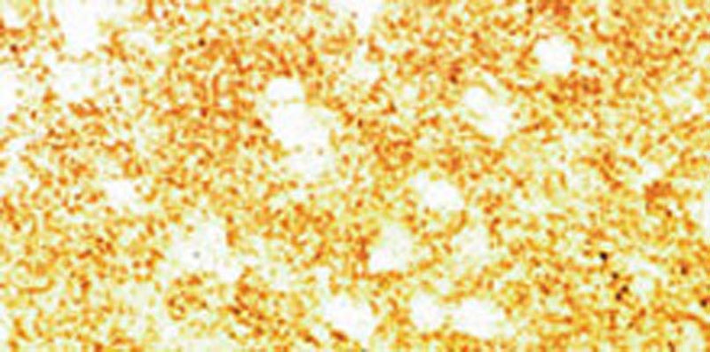 Immunohistochemical staining (paraffin-embedded tissue) of alpha synuclein in human neocortex using sheep polyclonal to human alpha synuclein, catalogue number S-078-50.