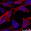 Immunofluorescence staining of alpha synuclein in cultured cells using Sheep antibody to alpha synuclein, catalog number S-078-50 and fluorescent-labelled secondary antibody. Image courtesy of Dr Wei-Ping Gai, Flinders University of South Australia.