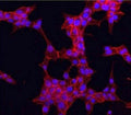Staining at cell junctions of active Catenin beta in INS-E cells in culture using Sheep polyclonal antibody to dephosphorylated Catenin beta S-1233-100.