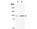 Western blot analysis of Catenin beta (S-1233-100) in extracts from HepG2 cells: untreated (Lane 1) and treated with GSK3 inhibitor (Lane 2).