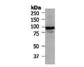Western blot analysis of Catenin beta (S-1234-100) in extracts from HT29 cells.