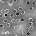 Transmission Electron Microscopy (TEM) negative staining of Dex-NPs