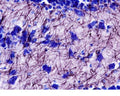 Bright field illumination (60X mag) of the dentate gyrus of a normal mouse reveals individual Black-Gold II stained myelinated fibres and Toluadine Blue O stained polymorph cells (centre) and granule cells (top). Photo is courtesy of Dr. Larry Schmued.