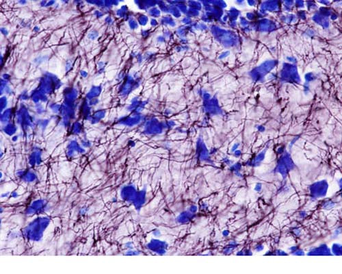 Bright field illumination (60X mag) of the dentate gyrus of a normal mouse reveals individual Black-Gold II stained myelinated fibres and Toluadine Blue O stained polymorph cells (centre) and granule cells (top). Photo is courtesy of Dr. Larry Schmued.