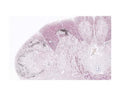 Human brain Locus K (Del Fiacco et al., Brain Struct Funct. 2014, 2019: 2083-2101; Cells 2018, 7, 72): calcitonin gene-related peptide-like immunoreactivity (black) and myelin staining (red, Black-Gold II staining kit, Biosensis) in the medulla oblongata, showing the similar neurochemical and structural organization of the dorsal column nuclei Locus K and the spinal trigeminal substantia gelatinosa.
