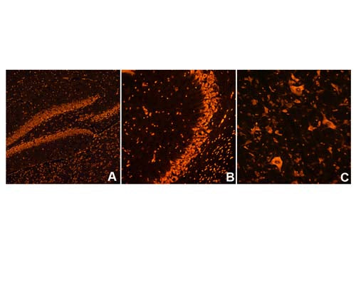 Image of mouse brain tissue (Images A, B, C by Immunofluorescence) stained with NisslFluor™ Red (TR-200-NRD).Prominent staining of neuronal soma and dendrites is observed, characteristic of healthy neurons