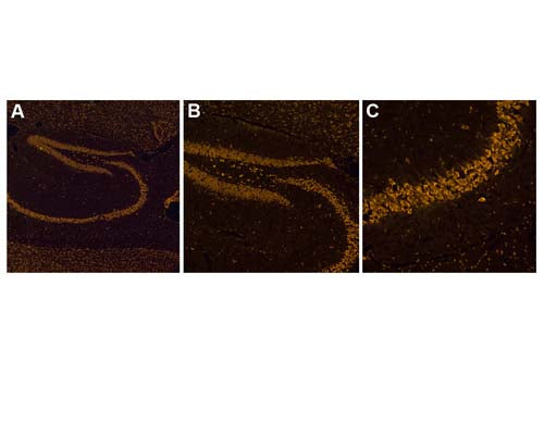 Image of mouse brain tissue (Images A, B, C by Immunofluorescence) stained with NisslFluor™ Orange (TR-210-NOR).Prominent staining of neuronal soma and dendrites is observed, characteristic of healthy neurons
