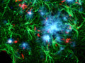 This triple exposure allows for the simultaneous localization of Amylo-Glo&reg; positive amyloid plaques (blue), GFAP positive hypertrophied astrocytes (green) and activated microglia (red) in the hippocampus of the AD/Tg mouse.Combined UV, blue and green light illumination.