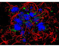 Staining of amyloid plaques (blue) in J20 line heterozygote adult mouse brain. Image represents 3-D reconstruction from confocal z-stack. Red: astrocytes stained for GFAP. Green: Aggregates of cofilin rods. Method: brain was fixed by perfusion with 4% paraformaldehyde cut at 30 um thickness on freezing microtome, and stained as free floating sections. Picture courtesy of Dr. John Chilton, University of Exeter, www.axonology.com.