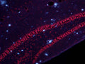 Combined Amylo-Glo labeling of amyloid plaques (blue)with ethidium bromide Nissl (cell body) counterstain (red) in the dentate gyrus region of the hippocampus of the AD/Tg mouse.UV light excitation.