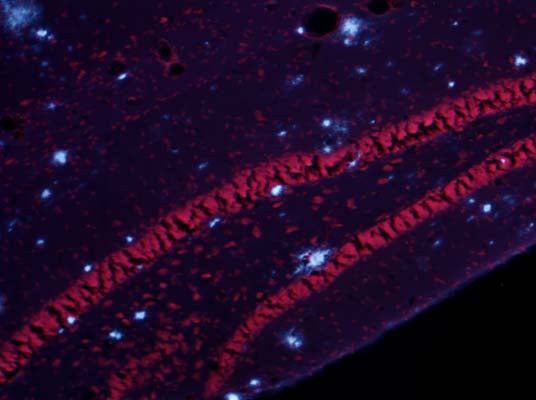 Combined Amylo-Glo labeling of amyloid plaques (blue)with ethidium bromide Nissl (cell body) counterstain (red) in the dentate gyrus region of the hippocampus of the AD/Tg mouse.UV light excitation.