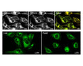 Comparison of TR-601-ER1 with ER-Tracker (upper panel). TR-601-ER1 can be used to stain the endoplasmic reticulum in live and fixed cells (lower panel).