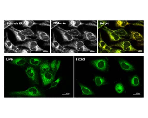 Comparison of TR-601-ER1 with ER-Tracker (upper panel). TR-601-ER1 can be used to stain the endoplasmic reticulum in live and fixed cells (lower panel).