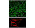 Staining of mitochondria in cardiomyocytes (top) and HeLa cells (bottom) with TR-602-Mito tracing reagent.